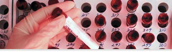 Hematology-Oncology