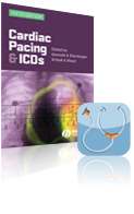Cardiac Pacing and ICDs