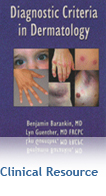 Diagnostic Criteria in Dermatology