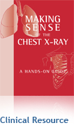 Making Sense of the Chest X-Ray