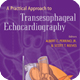 A Practical Approach to Transesophageal Echocardiography