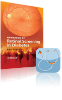 Handbook of Retinal Screening in Diabetes