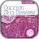 Common Skin Diseases