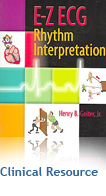 E-Z ECG Rhythm Interpretation