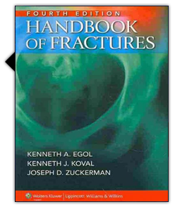 Handbook of Fractures | Skyscape